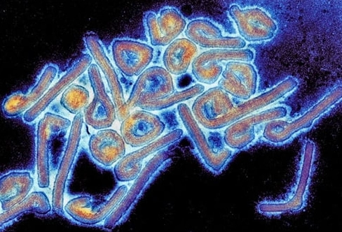 ไวรัสมาร์บวร์ก อันตรายเทียบเท่าอีโบลา
